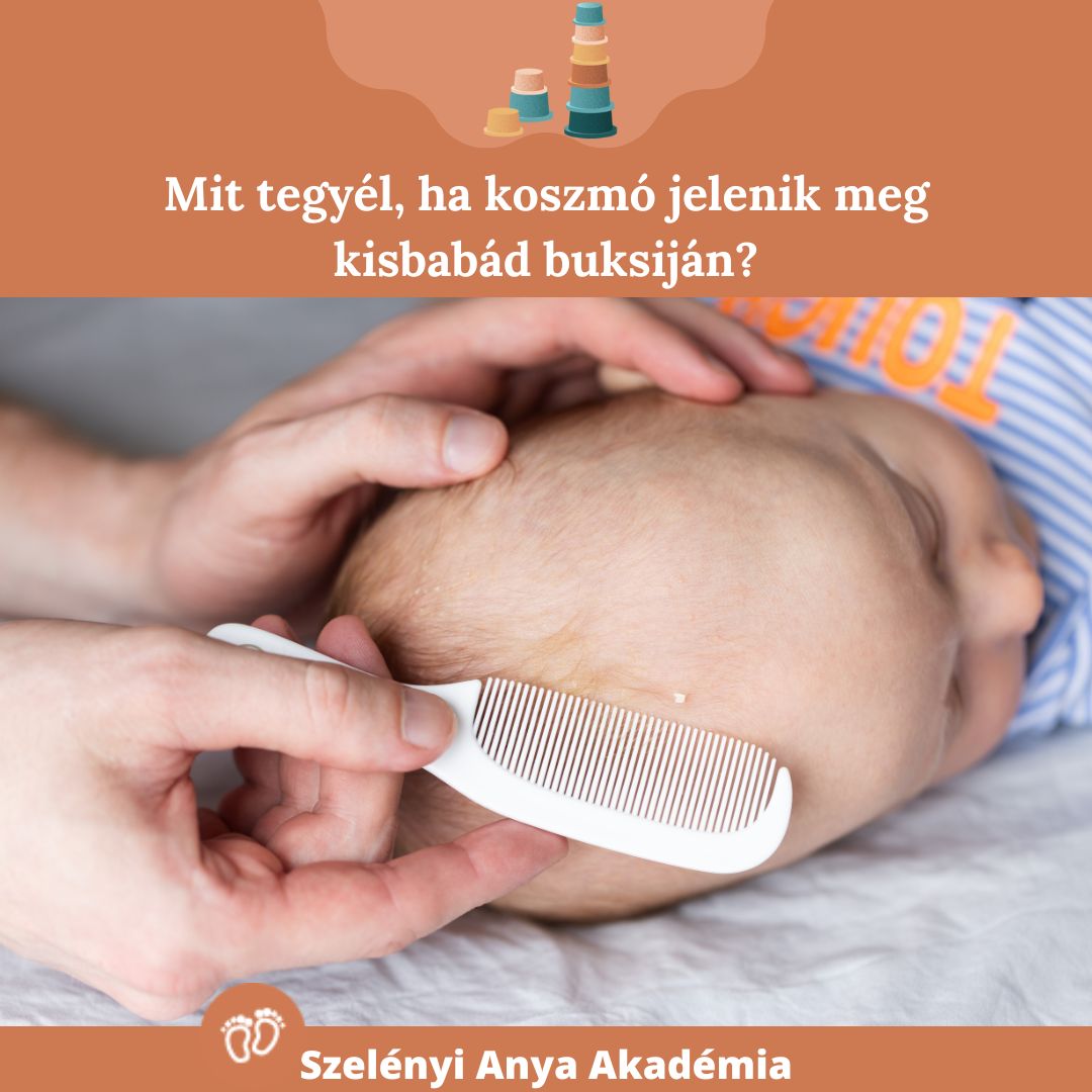 koszmó lett a baba fején